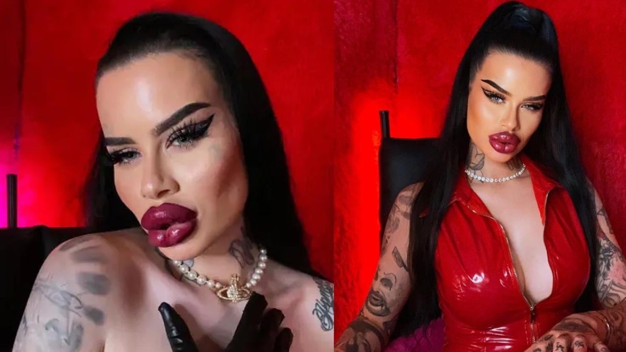 Estetik Bağımlılığı Çığırından Çıktı! 2 Milyon TL Harcadı, Yüzü Tanınmaz Halde 28 494235