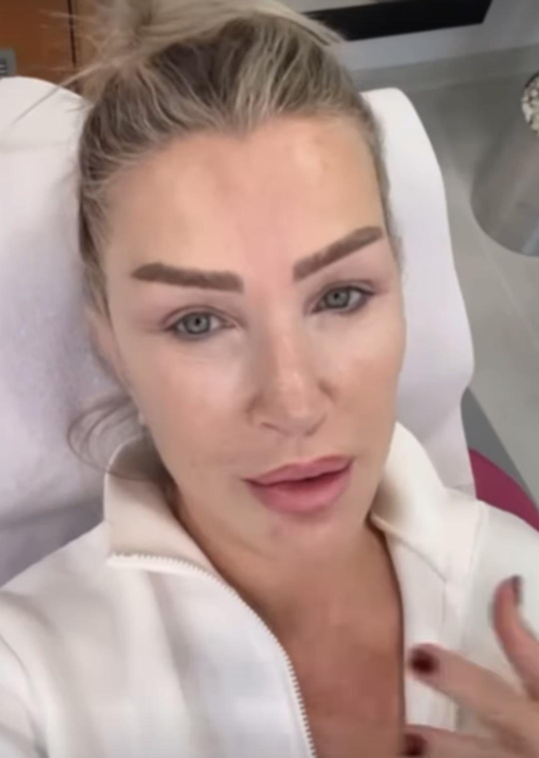 Seda Sayan, Yenidoğan Göbek Bağı ( eksozom) ile Yüz Tedavisi Yaptırdı 11 494735