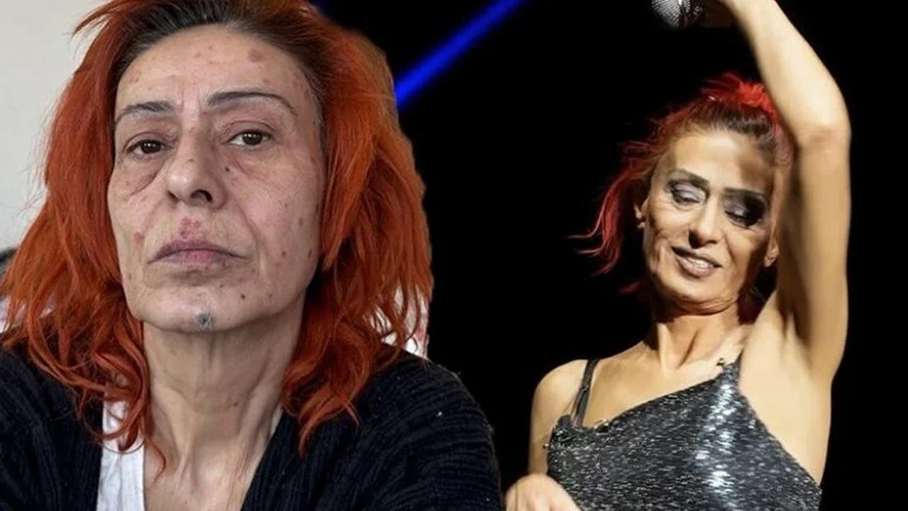 Yıldız Tilbe'nin yüzünde yanıklar oluşmuştu; Olayın perde arkasını anlattı 7 500108